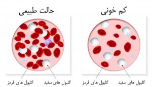 تعداد گلبول های قرمز در خون