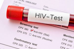 هزینه آزمایش ایدز، مراکز آزمایش رایگان ایدز